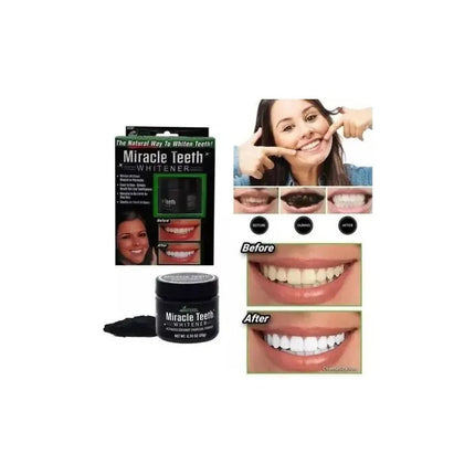 Blanqueador Dental  De Carbon Blanqueamiento Dientes