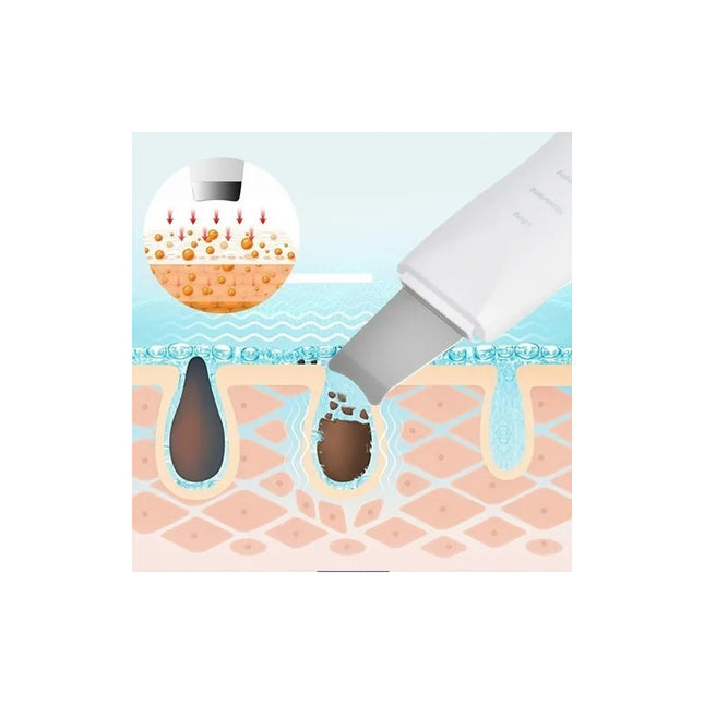 Espatula Removedor Ultrasónica Facial Exfolia Usb Recargable
