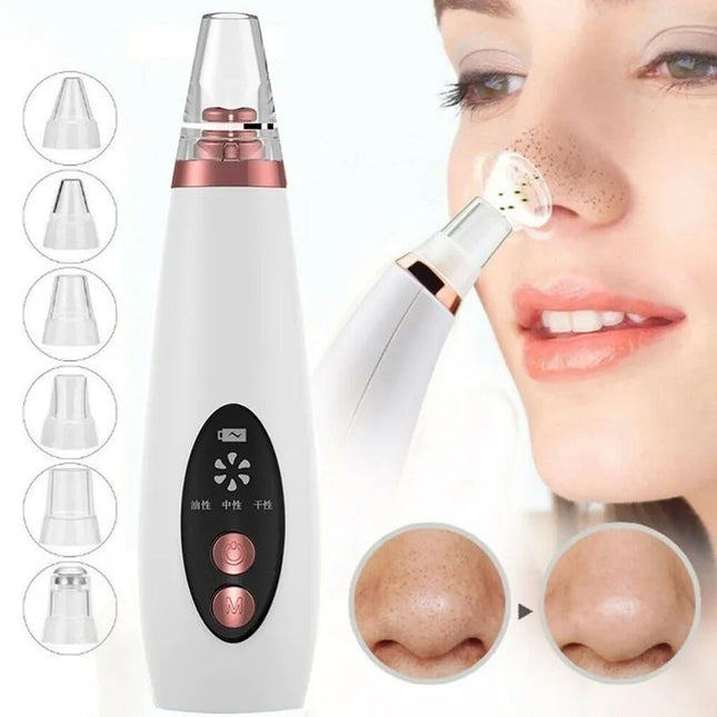 Limpiador Facial Y Extractor Puntos Negro