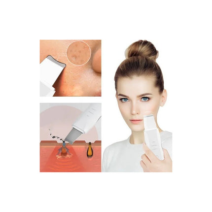 Espatula Removedor Ultrasónica Facial Exfolia Usb Recargable