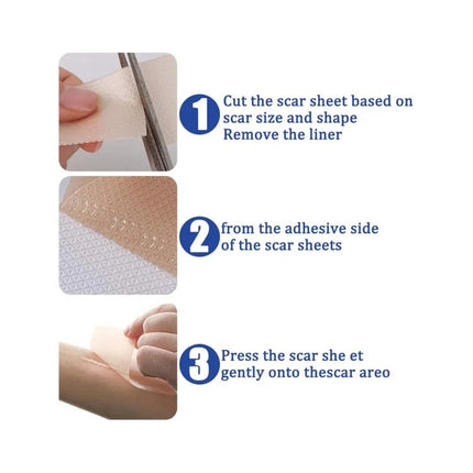 Parche Reductor De Cicatrices X4 Pcs. Silicone Scar Beige