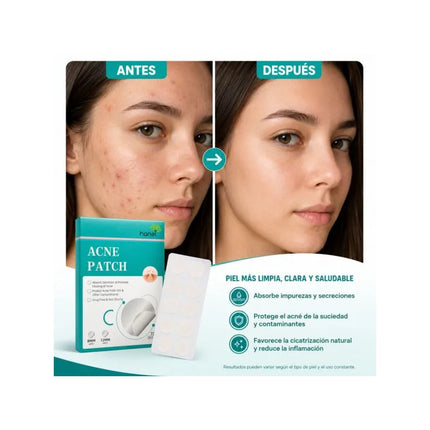 Parches Reductores De Acné 72pcs.