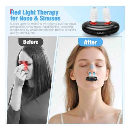 Dilatador Nasal  Con Terapia De Luz Roja Anti-ronquidos