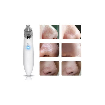 Extractor De Puntos Negros Granos Acne Exfoliante