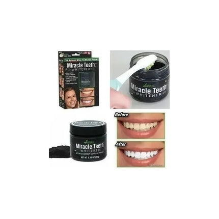 Blanqueador Dental  De Carbon Blanqueamiento Dientes Blanco