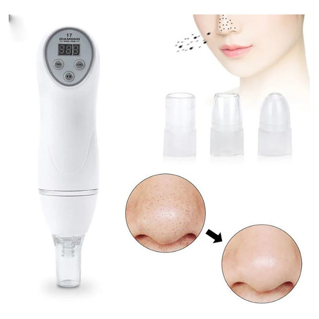 Limpiador Facial Microdermoabrasion Puntas De Diam