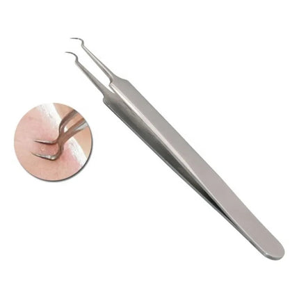Kit Removedor De Puntos Negros Con Agujas Y Pinzas