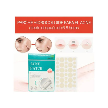 Parches Reductores De Acné 72pcs.
